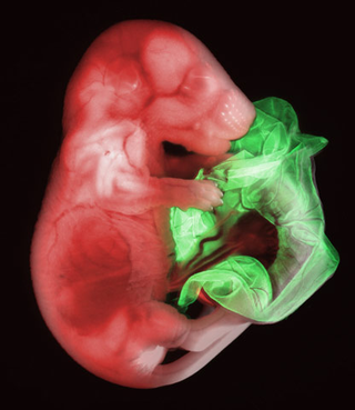 Illustration for article titled Remarkable Nikon Small World Microscope Photography Winners